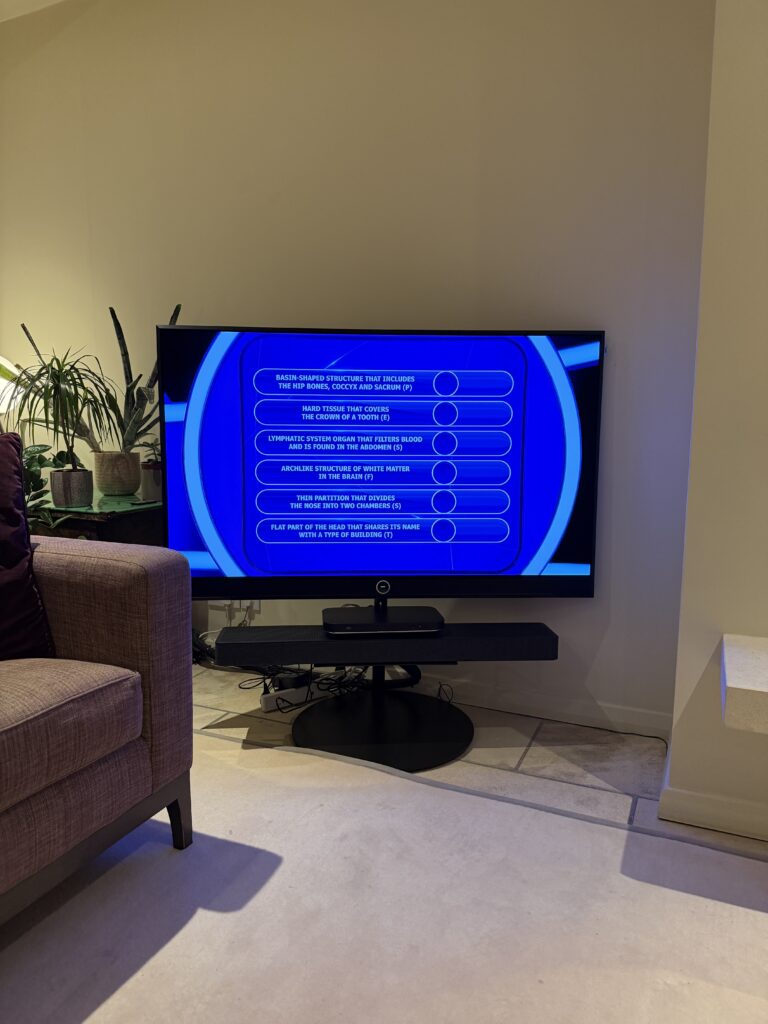 Loewe Stellar oled smart tv